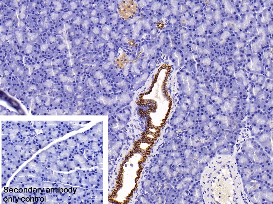 Polyclonal Antibody to Keratin 6A (KRT6A)