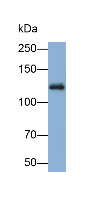 Polyclonal Antibody to Tyrosine Protein Kinase 7 (PTK7)