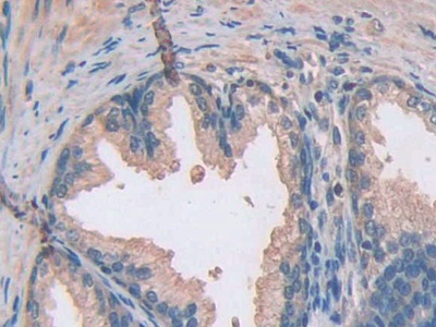 Polyclonal Antibody to Ataxin 10 (ATXN10)