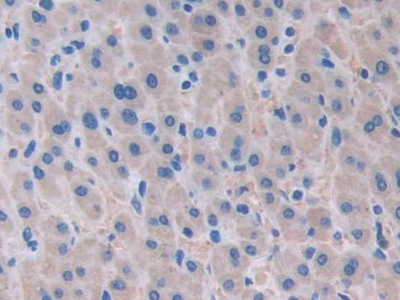 Polyclonal Antibody to Ataxin 10 (ATXN10)