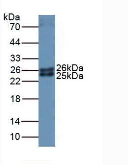 Polyclonal Antibody to Ferritin, Mitochondrial (FTMT)