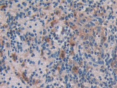 Polyclonal Antibody to Ferritin, Mitochondrial (FTMT)