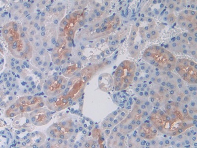 Polyclonal Antibody to Ferritin, Mitochondrial (FTMT)