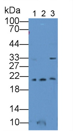 Polyclonal Antibody to Ferritin, Mitochondrial (FTMT)