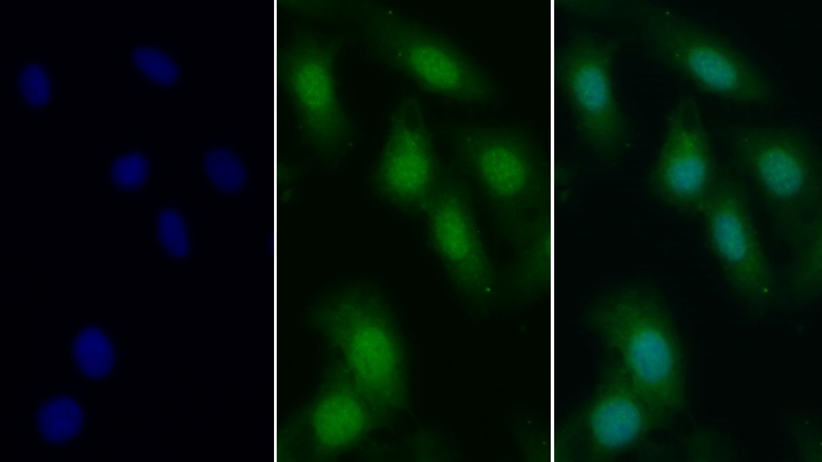 Polyclonal Antibody to Cyclin A1 (CCNA1)