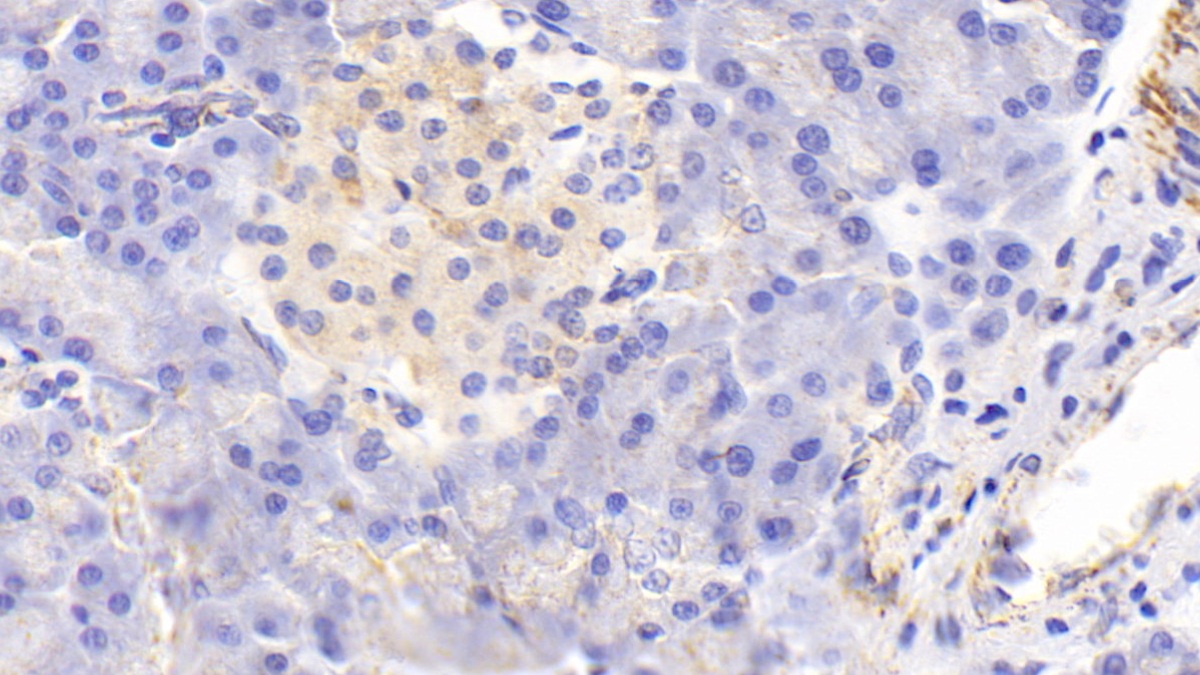 Polyclonal Antibody to Cytochrome C Oxidase Subunit II (COX2)