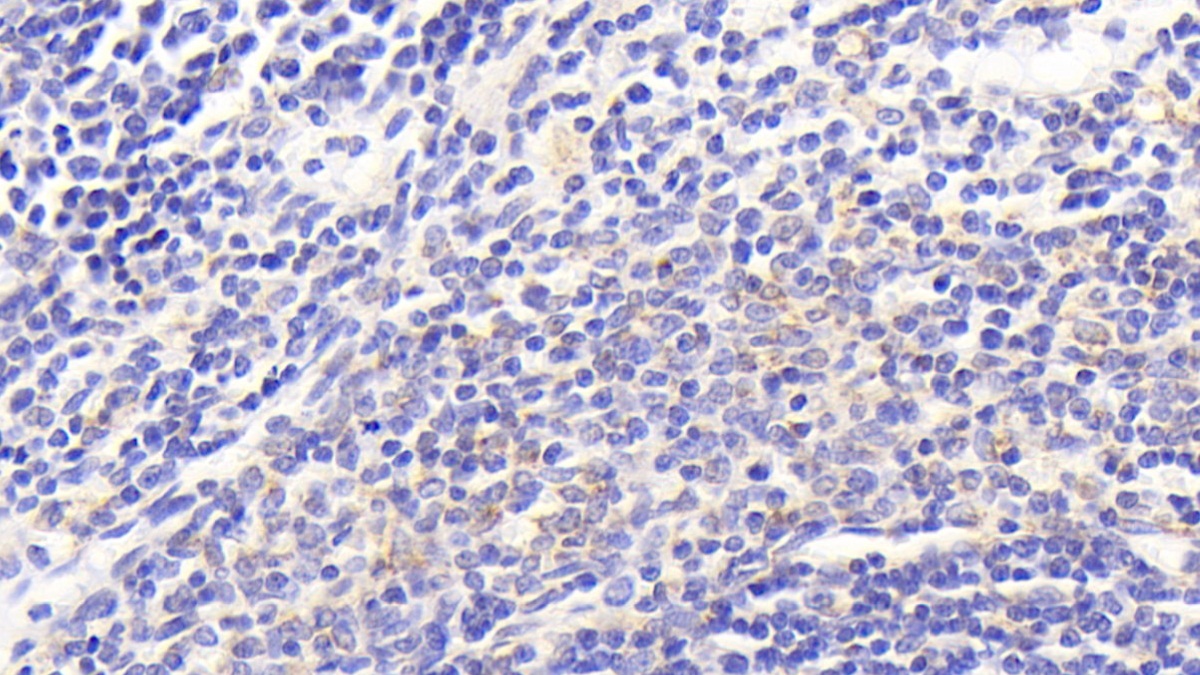 Polyclonal Antibody to Cytochrome C Oxidase Subunit II (COX2)