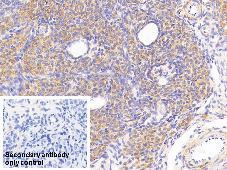 Polyclonal Antibody to Cytochrome C Oxidase Subunit II (COX2)