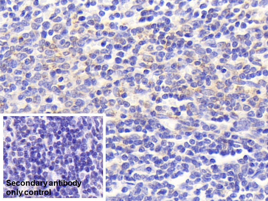 Polyclonal Antibody to Cytochrome C Oxidase Subunit II (COX2)