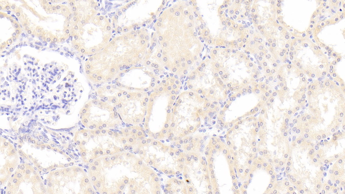 Polyclonal Antibody to Cytochrome C Oxidase Subunit IV Isoform 1 (COX4I1)