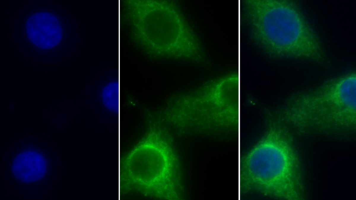 Polyclonal Antibody to Cytochrome C Oxidase Subunit IV Isoform 1 (COX4I1)