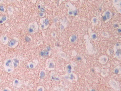 Polyclonal Antibody to Cytochrome P450 1A2 (CYP1A2)