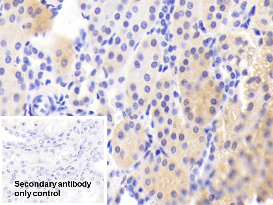 Polyclonal Antibody to Cytochrome P450 2D6 (CYP2D6)