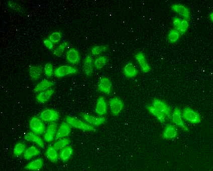 Polyclonal Antibody to Holocytochrome C Synthase (HCCS)