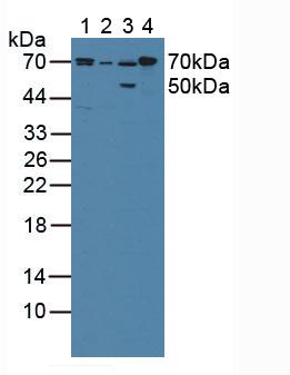 Polyclonal Antibody to Cytochrome P450 Reductase (CPR)