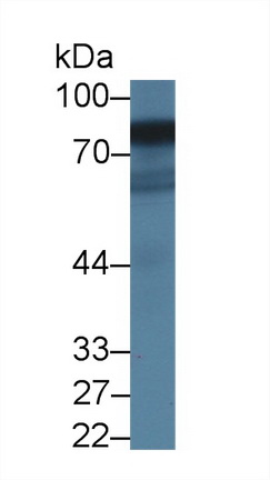 Polyclonal Antibody to Cytochrome P450 Reductase (CPR)