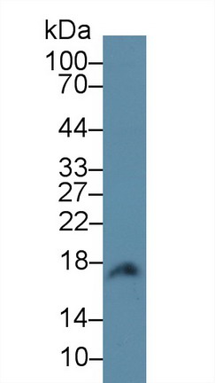 Polyclonal Antibody to Calmodulin 1 (CALM1)