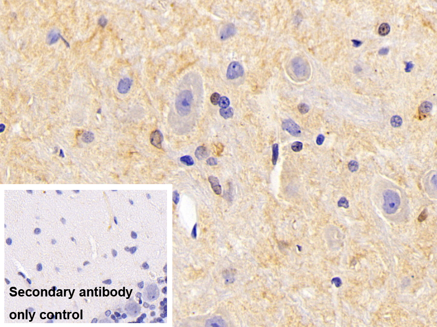 Polyclonal Antibody to Glycogen Synthase Kinase 3 Beta (GSK3b)