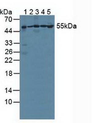 Polyclonal Antibody to Proteasome 26S Subunit, ATPase 1 (PSMC1)