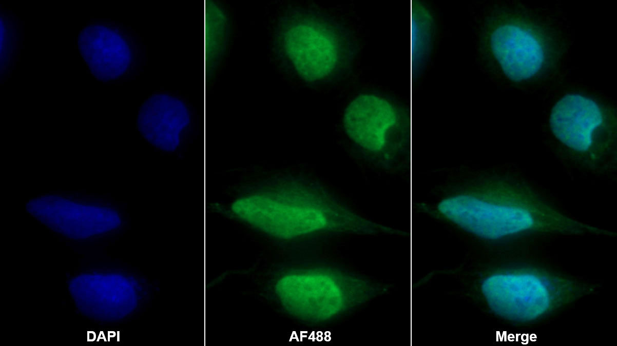 Polyclonal Antibody to Proteasome 26S Subunit, ATPase 1 (PSMC1)