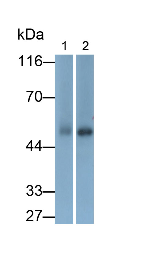 Polyclonal Antibody to Calcium/Calmodulin Dependent Protein Kinase II Alpha (CAMK2a)