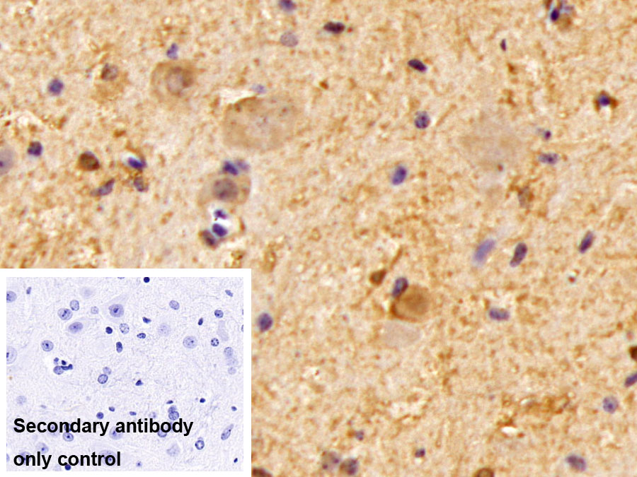 Polyclonal Antibody to Calcium/Calmodulin Dependent Protein Kinase II Alpha (CAMK2a)