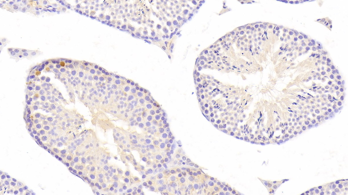 Polyclonal Antibody to Interleukin 17C (IL17C)