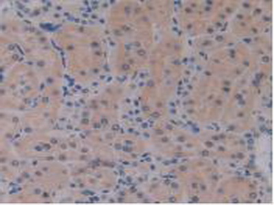 Polyclonal Antibody to Interleukin 17 Receptor E (IL17RE)