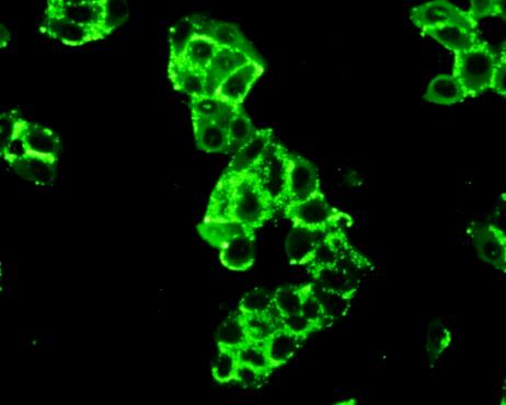 Polyclonal Antibody to Hexokinase 2 (HK2)