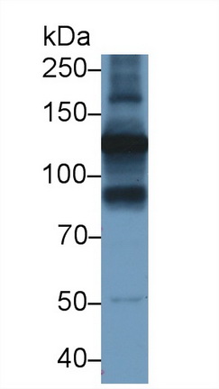 Polyclonal Antibody to Hexokinase 2 (HK2)