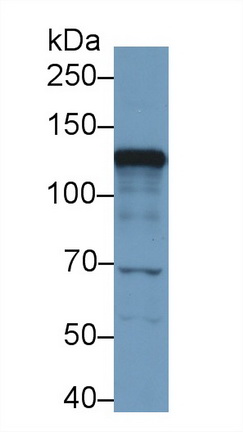 Polyclonal Antibody to Hexokinase 2 (HK2)