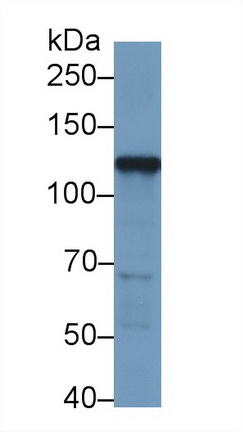 Polyclonal Antibody to Hexokinase 2 (HK2)