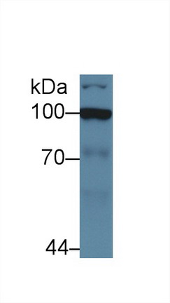 Polyclonal Antibody to Hexokinase 2 (HK2)