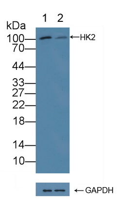 Polyclonal Antibody to Hexokinase 2 (HK2)