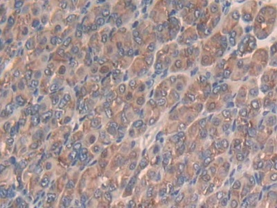 Polyclonal Antibody to Slit Homolog 3 (Slit3)