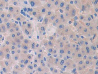 Polyclonal Antibody to Slit Homolog 1 (Slit1)