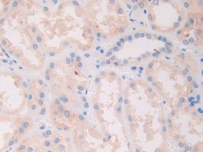 Polyclonal Antibody to Slit Homolog 1 (Slit1)