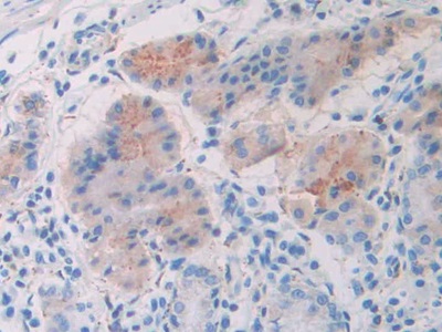 Polyclonal Antibody to Slit Homolog 1 (Slit1)