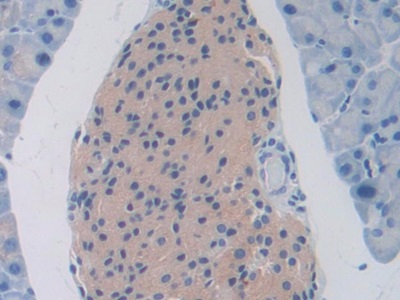 Polyclonal Antibody to Slit Homolog 1 (Slit1)