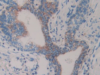 Polyclonal Antibody to Slit Homolog 1 (Slit1)