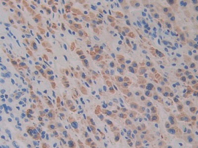 Polyclonal Antibody to Slit Homolog 1 (Slit1)