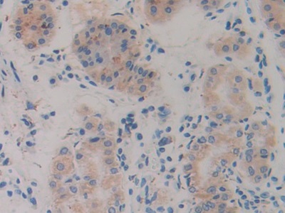 Polyclonal Antibody to Slit Homolog 1 (Slit1)