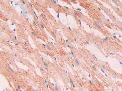 Polyclonal Antibody to Slit Homolog 1 (Slit1)