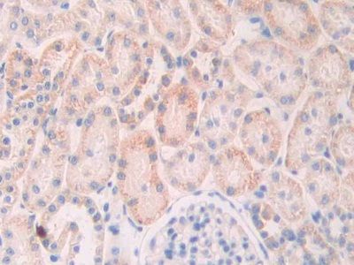 Polyclonal Antibody to Slit Homolog 1 (Slit1)