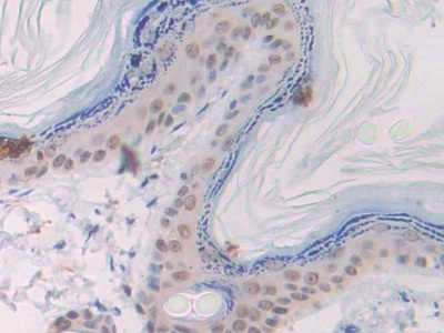 Polyclonal Antibody to Slit Homolog 1 (Slit1)