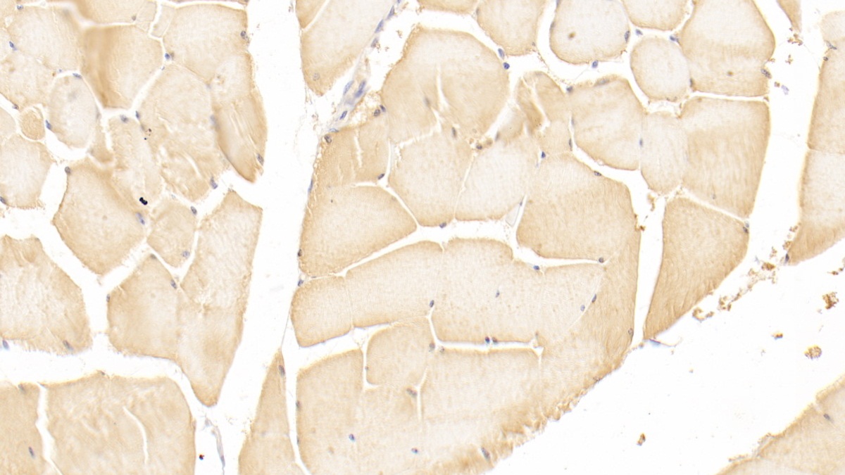 Polyclonal Antibody to Protein Kinase, AMP Activated Gamma 1 (PRKAg1)