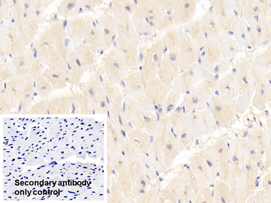 Polyclonal Antibody to Protein Kinase, AMP Activated Gamma 1 (PRKAg1)