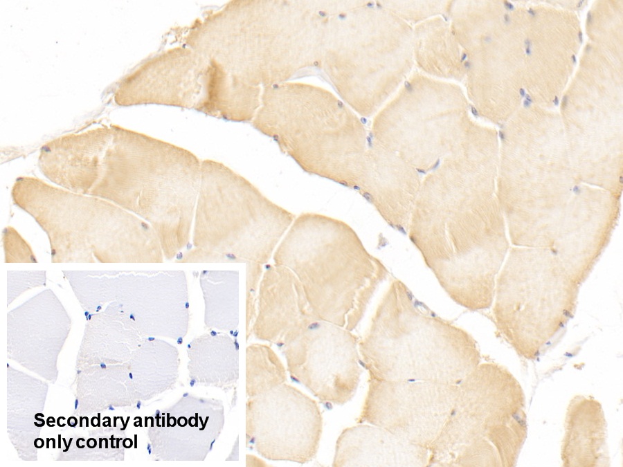 Polyclonal Antibody to Protein Kinase, AMP Activated Gamma 1 (PRKAg1)