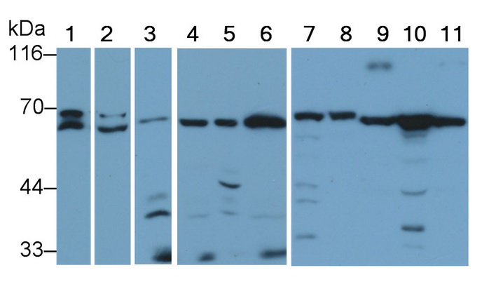 Polyclonal Antibody to Protein Kinase, AMP Activated Alpha 2 (PRKAa2)