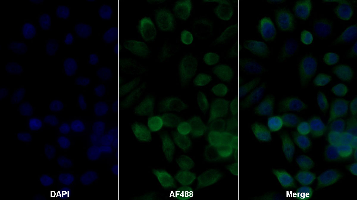 Polyclonal Antibody to Protein Kinase, AMP Activated Alpha 2 (PRKAa2)